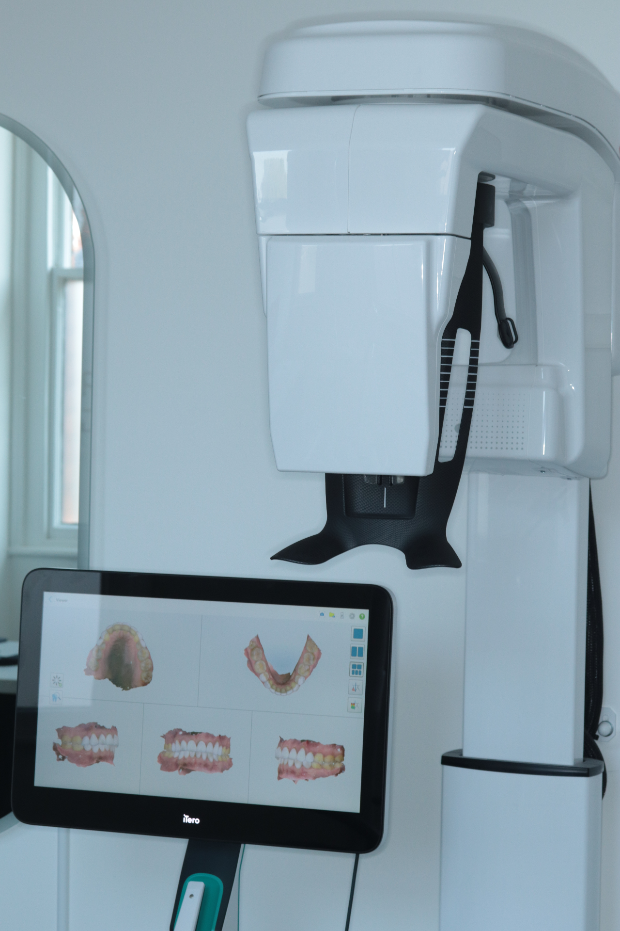 iTero digital scanner displaying a 3D dental scan